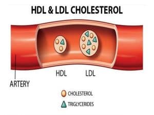 LDL Cholesterol